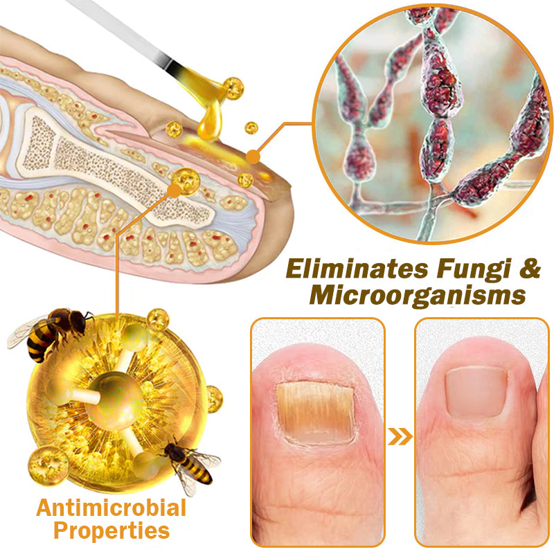 Nail Fungus Bee Venom Treatment Serum 🔥 Limited-time offer 60% 🔥