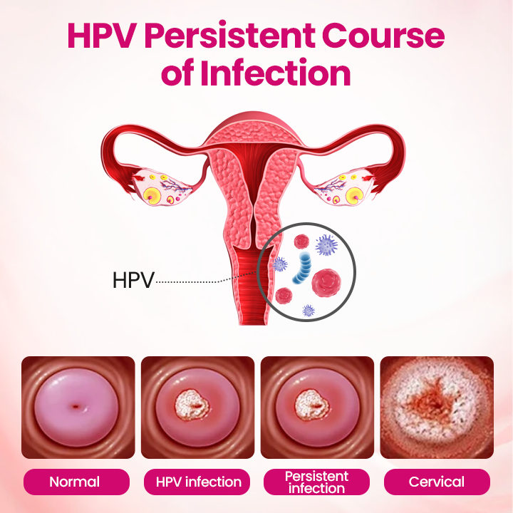 IntiDefend Anti-HPV Interferon Gel