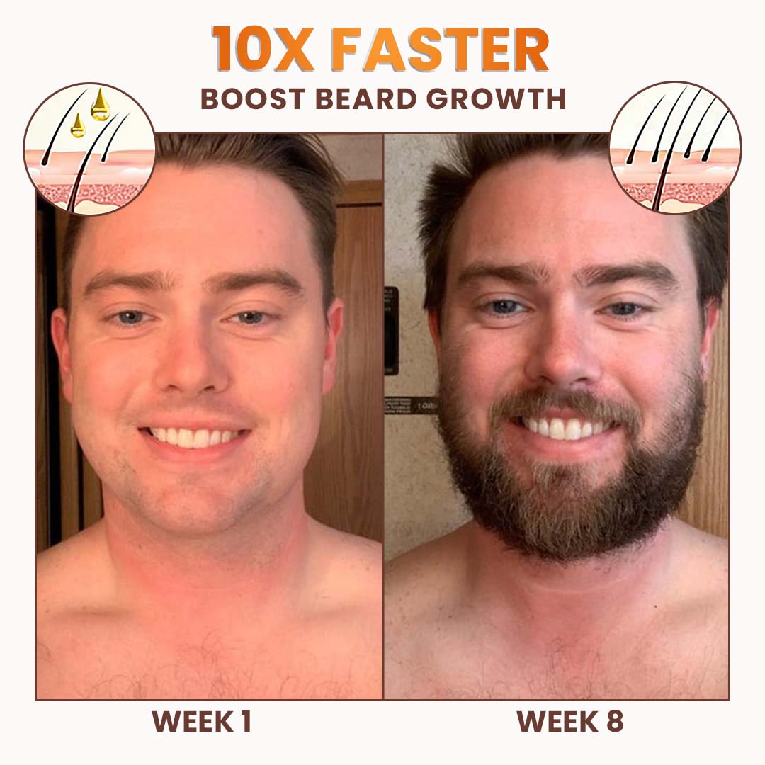 Premium Biotin Hair&Beard Booster đ„ Sale up to 80% Discounts