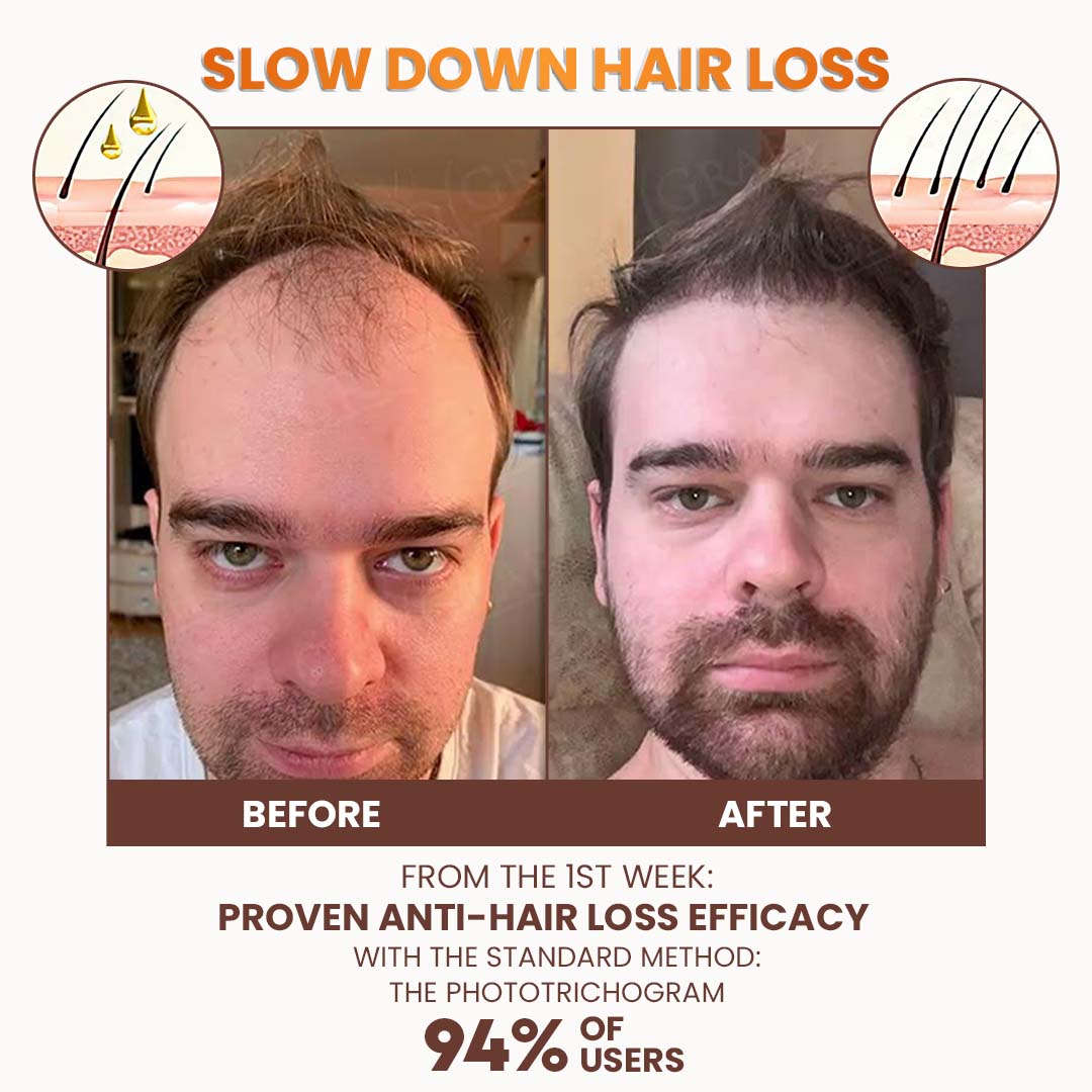 Premium Biotin Hair&Beard Booster đ„ Sale up to 80% Discounts