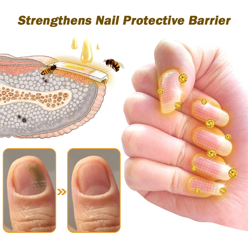 Nail Fungus Bee Venom Treatment Serum 🔥 Limited-time offer 60% 🔥