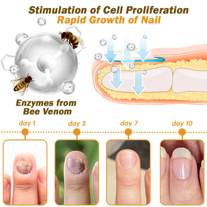 Nail Fungus Bee Venom Treatment Serum 🔥 Limited-time offer 60% 🔥