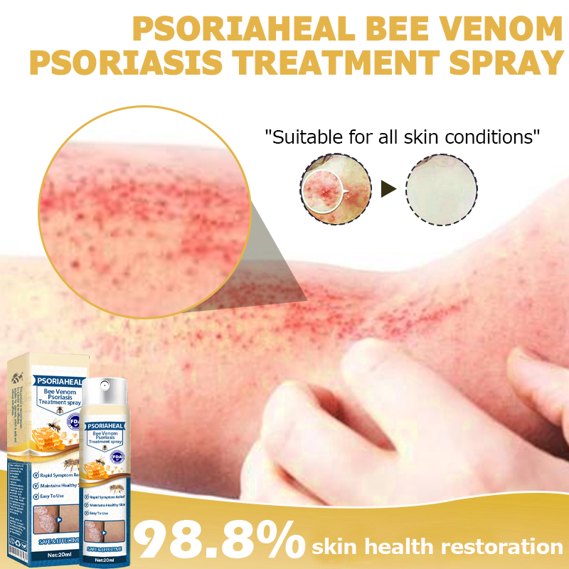 PsoriaHeal Bee Venom Psoriasis Treatment Spray 🔥 Last Day Sale Off 60%🔥