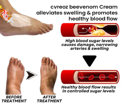 BeeVenom Diabetic Wounds Treatment Cream 🔥 Limited-time offer 60% 🔥