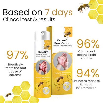 Bee Venom Eczema Treatment Spray – 💥 Last Day Sale Off 60% 🔥